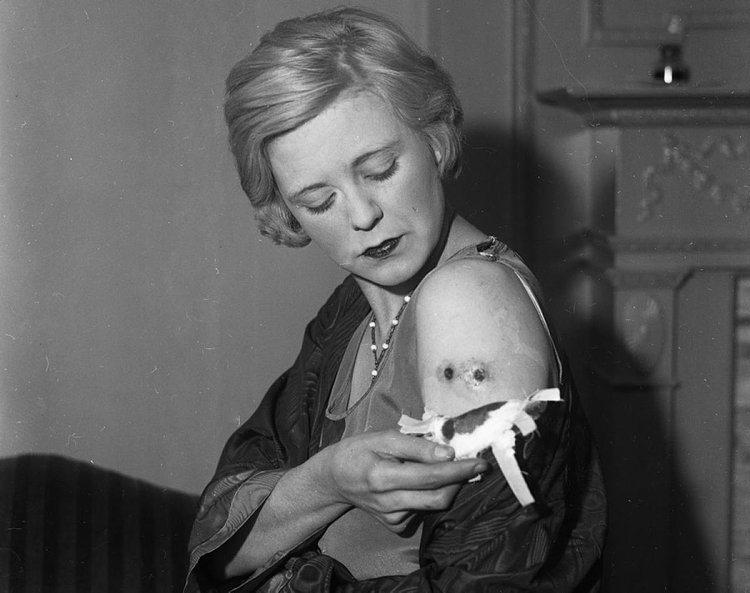 Mob Moll, 1931: Love is pain, right? Actress Alice Granville shows off two bullet holes in her arm at Roosevelt Hospital after she was shot by her hitman husband, lieutenant of Dutch Schultz Pete Donahue, in 1931. The mob moll said Donahue shot her at a nightclub party to prove his affection.