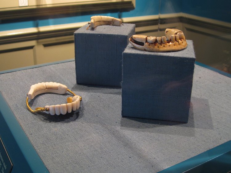George Washington's Dentures