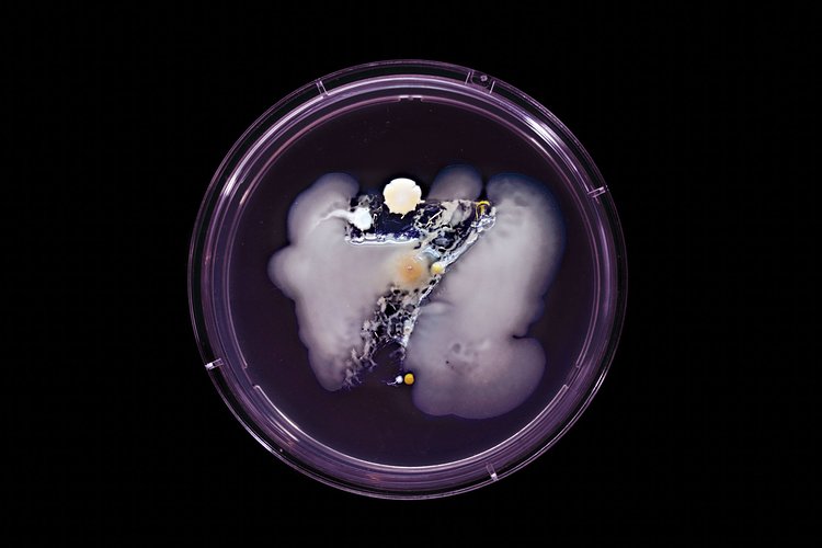 7 Train: Contains Staphylococcus aureus, Micrococcus luteus